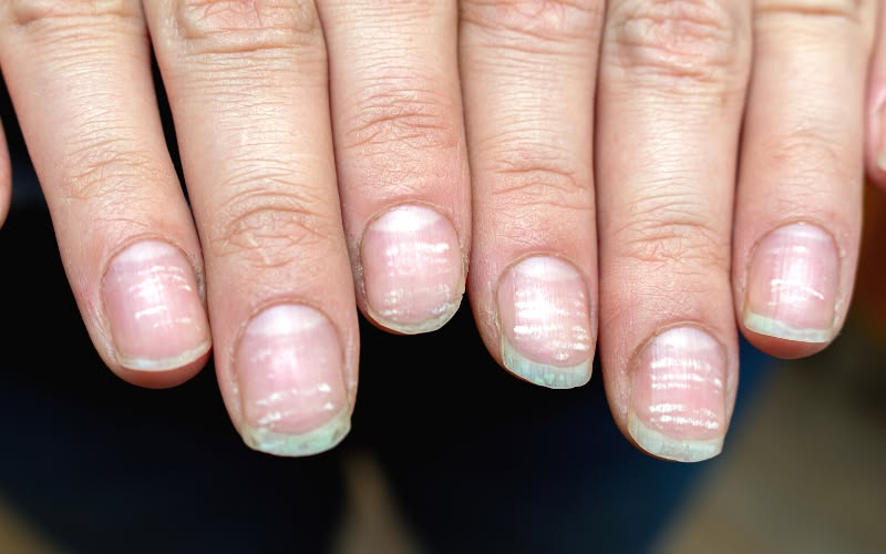 Nail Care