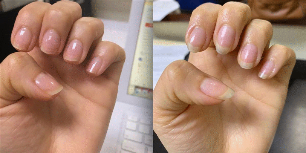 Nail Care