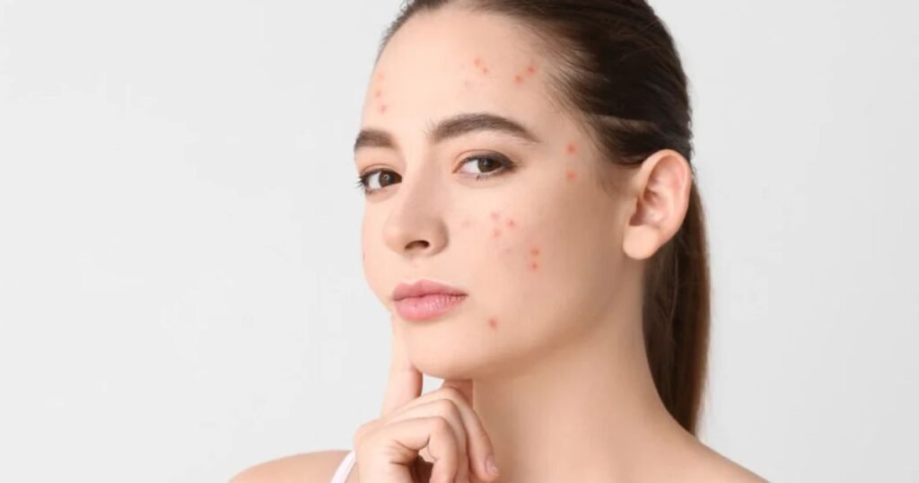 Daily skincare routine for clearer and healthier-looking skin